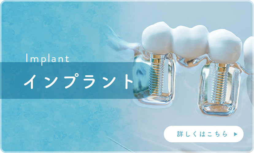 インプラント