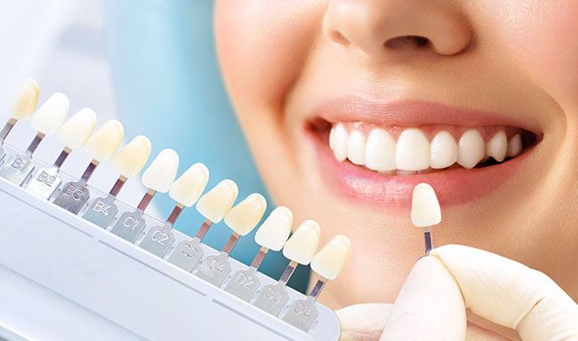 ホワイトニング